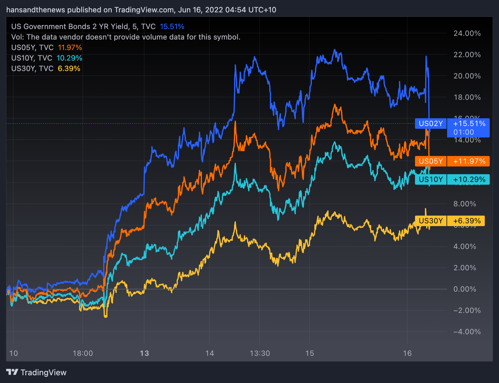 The one-week change in US yields. (Source: Trading View)