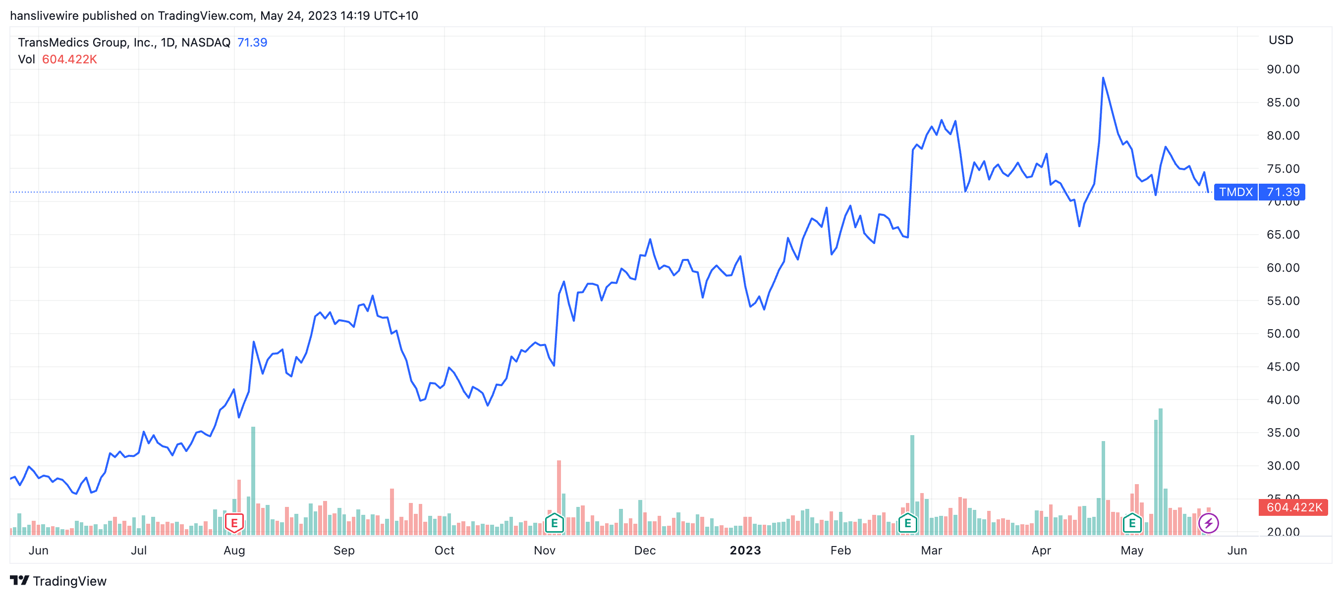 TransMedics (NAS: TMPX) over the last year. (Source: TradingView)