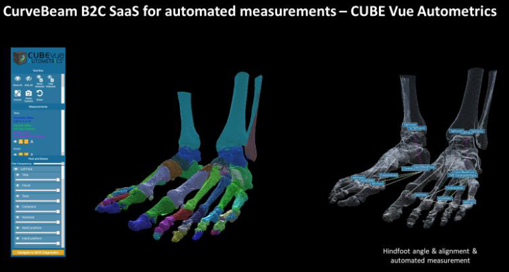 CubeVue software on HiRise for bone segmentation analysis